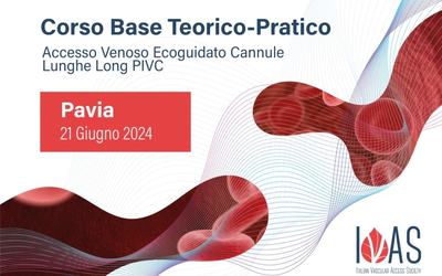Notizia di esempio